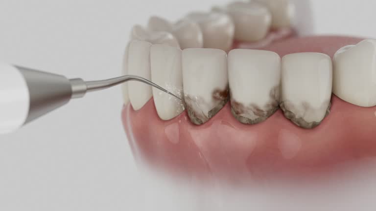Trusted Root Canal Treatment service in Waterville, ME - Dentist Open Now